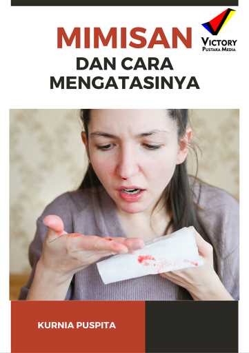 Mimisan dan Cara Mengatasinya